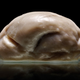 Imagen para el artículo titulado Este es uno de los cerebros humanos más extraños jamás observados